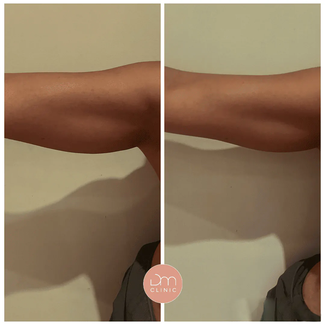 Resultado antes e depois de tratamento na DM Clinic