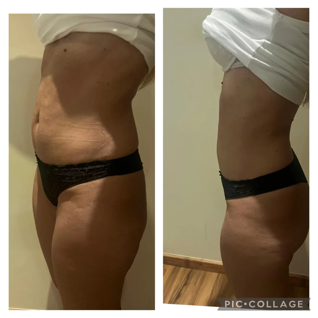 Resultado antes e depois de tratamento na DM Clinic