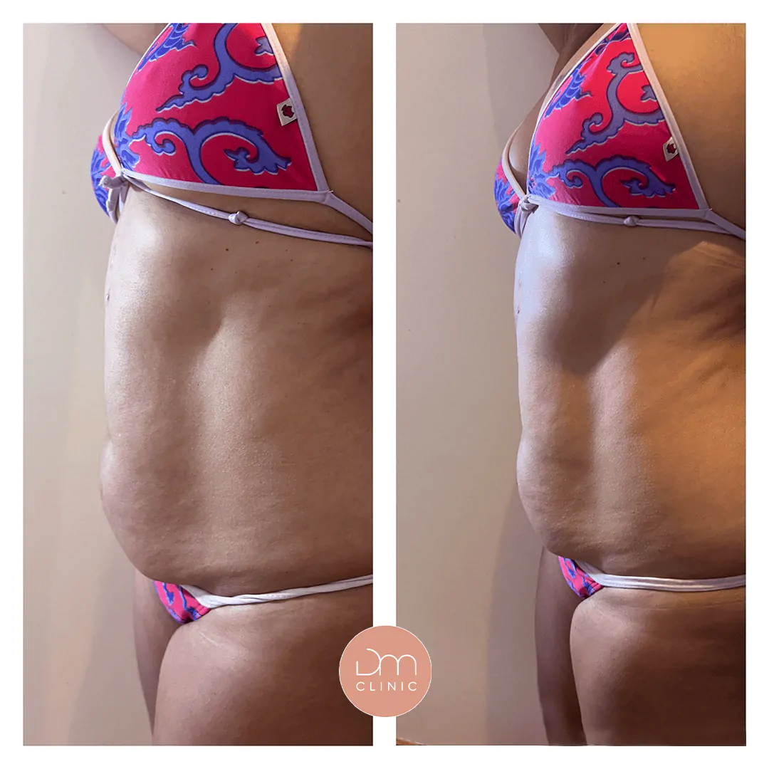 Resultado antes e depois de tratamento na DM Clinic