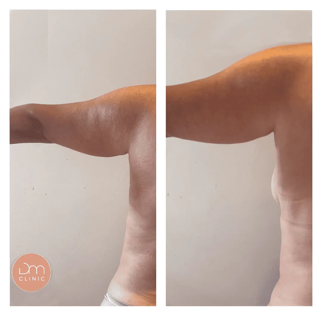 Resultado antes e depois de tratamento na DM Clinic