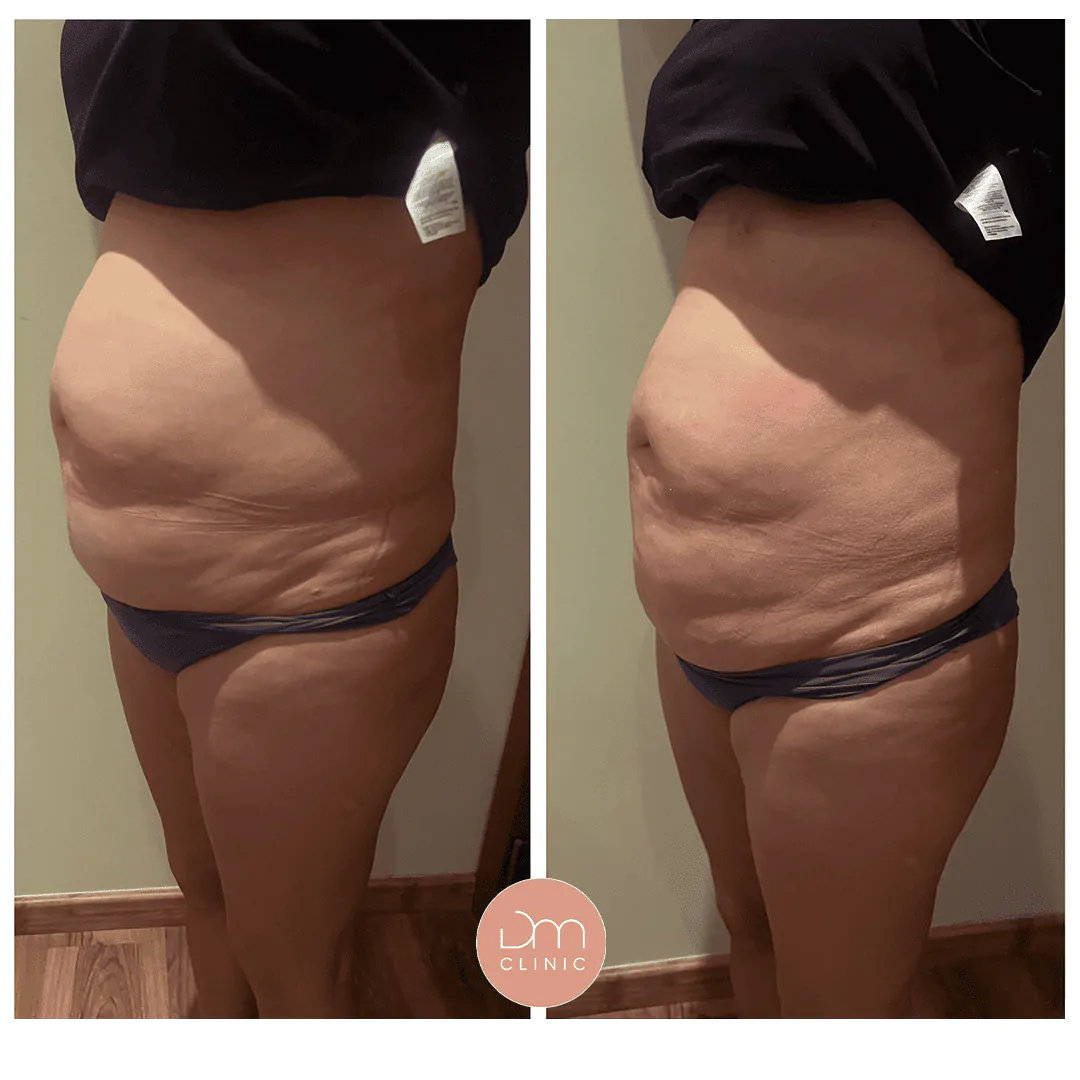 Resultado antes e depois de tratamento na DM Clinic