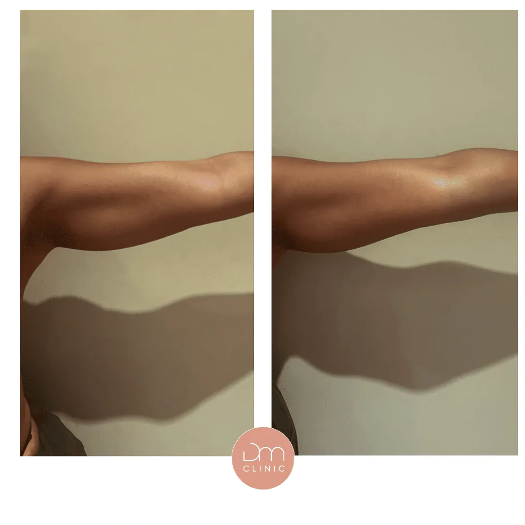 Resultado antes e depois de tratamento na DM Clinic
