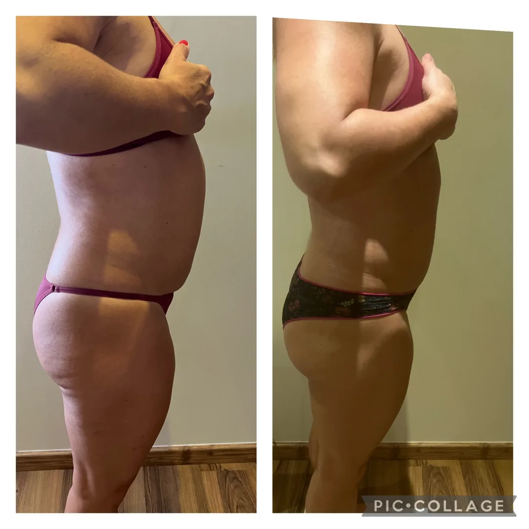 Resultado antes e depois de tratamento na DM Clinic