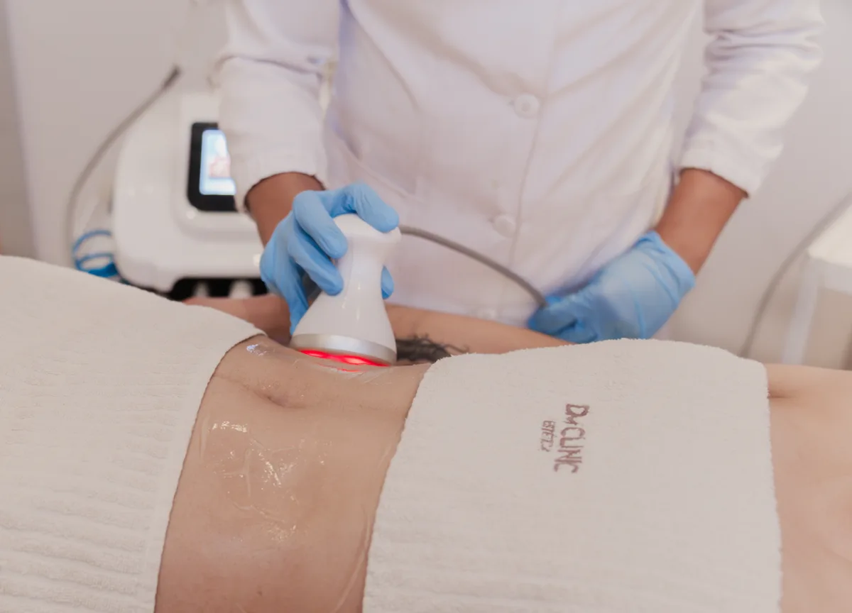 CAVITAÇÃO na DM Clinic