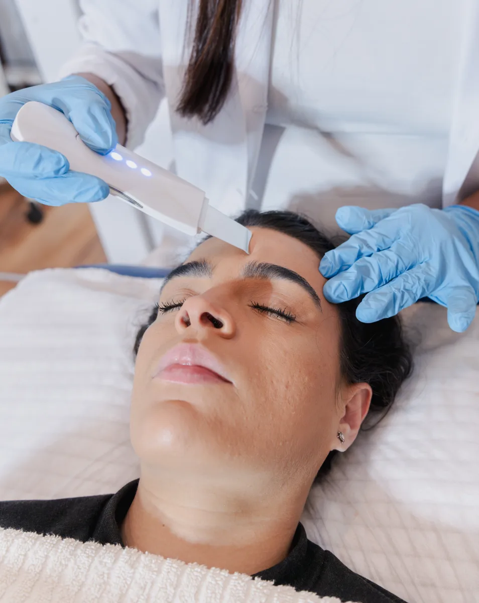 PEELINGS — ULTRASSÓNICO E QUÍMICO na DM Clinic