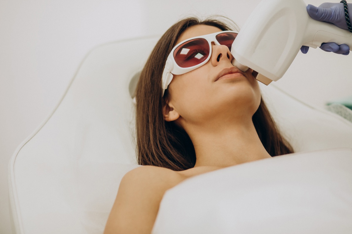 REMOÇÃO DE PELOS FACIAIS na DM Clinic
