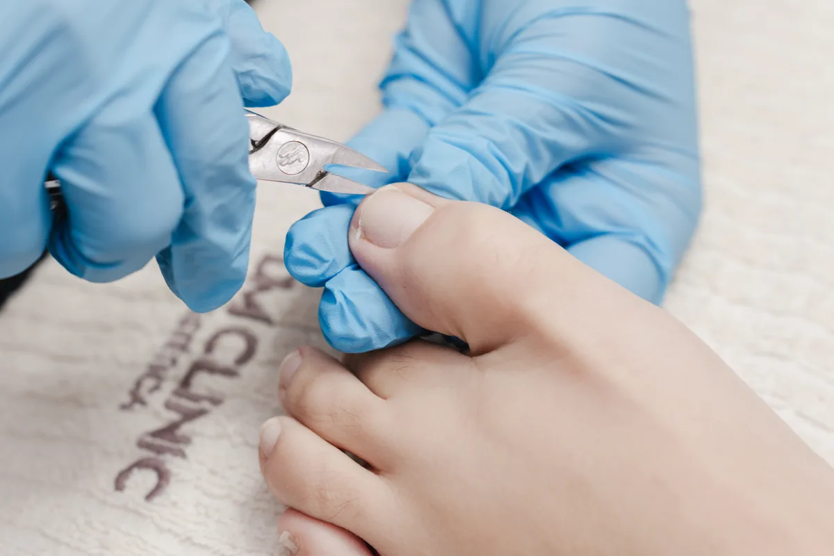 TÉCNICAS DE PODOLOGIA na DM Clinic